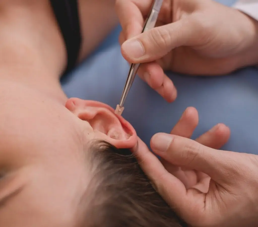Cursos Profissionalizantes Presencial ou On-line na Faculdade Eleven - Curso de Auriculoterapia