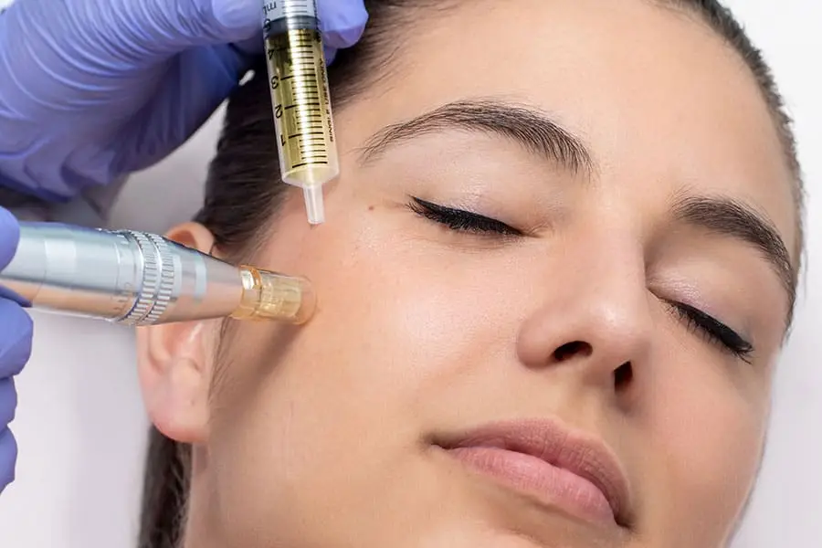 Curso de Microagulhamento Avançado. A Indução Percutânea de Colágeno é um procedimento com tendência mundial para tratamento estético!